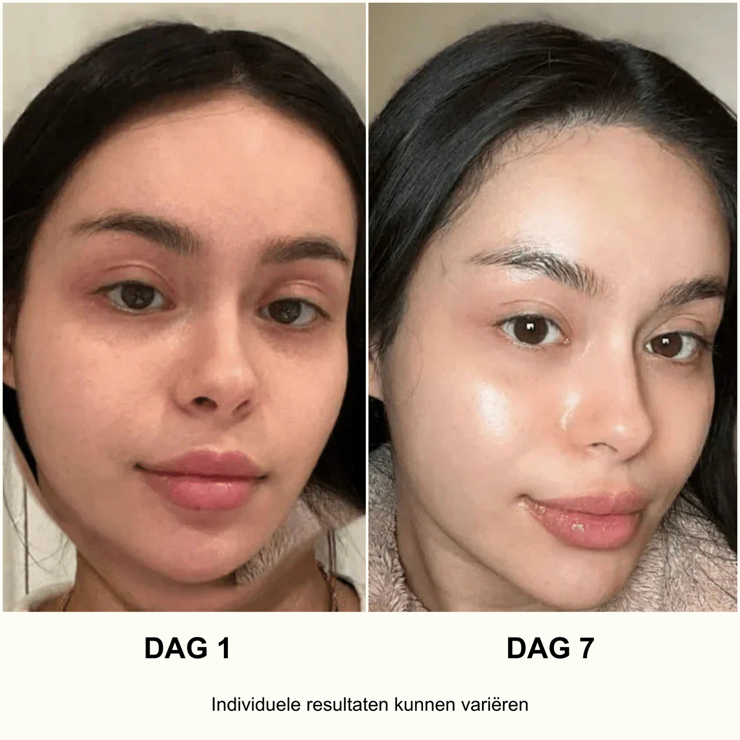 ANUA Ultieme Koreaanse Huidverzorgingsset