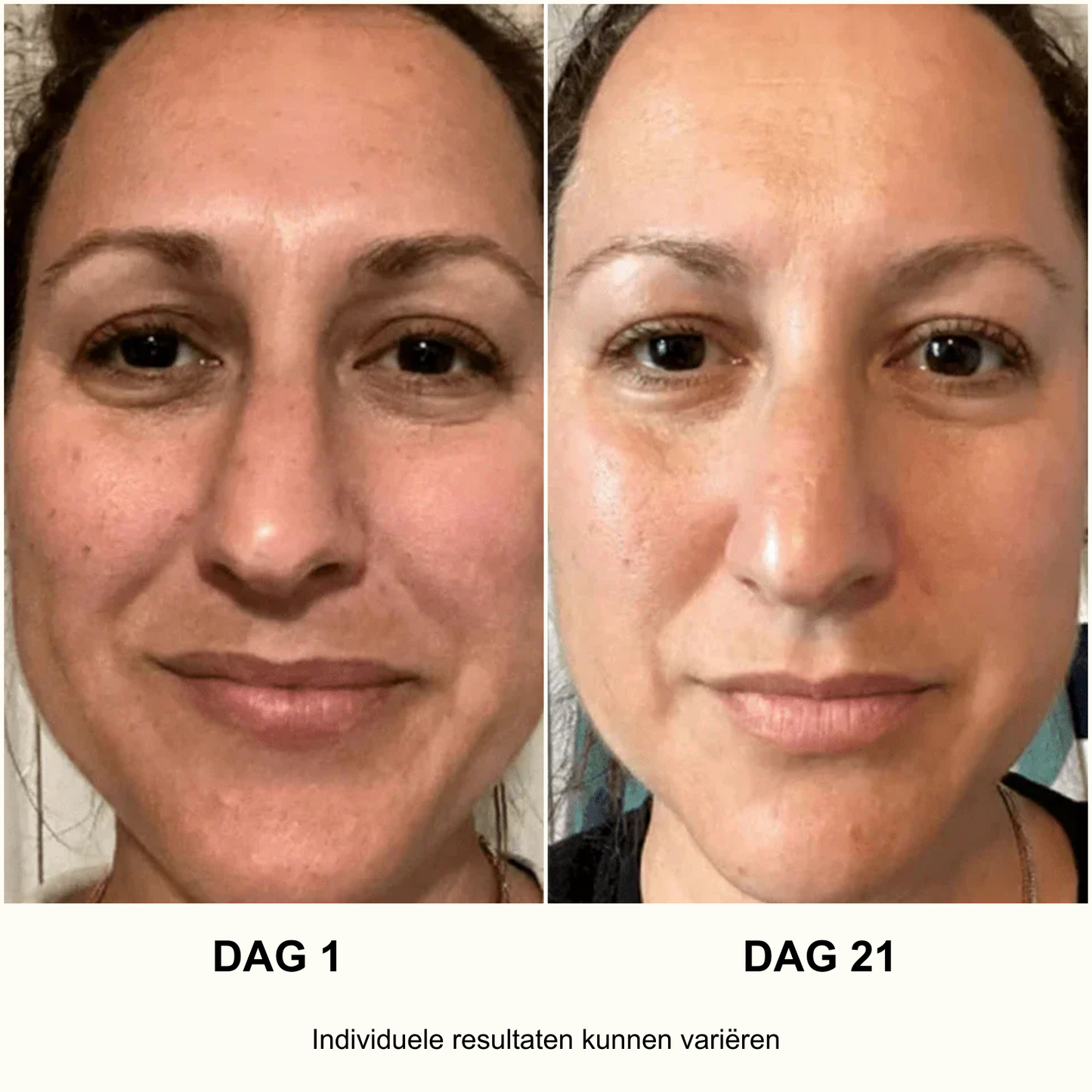 ANUA Ultieme Koreaanse Huidverzorgingsset