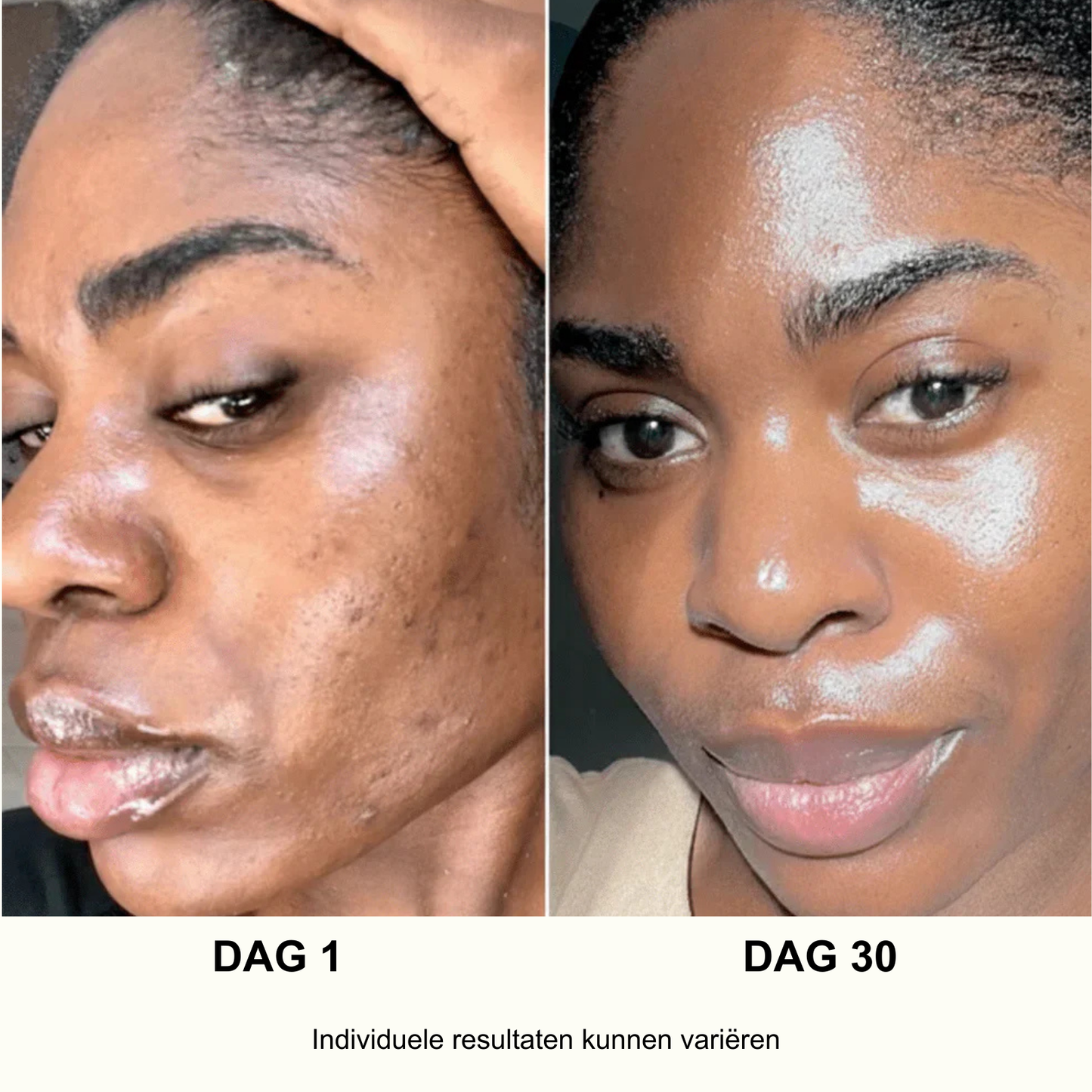 ANUA Ultieme Koreaanse Huidverzorgingsset