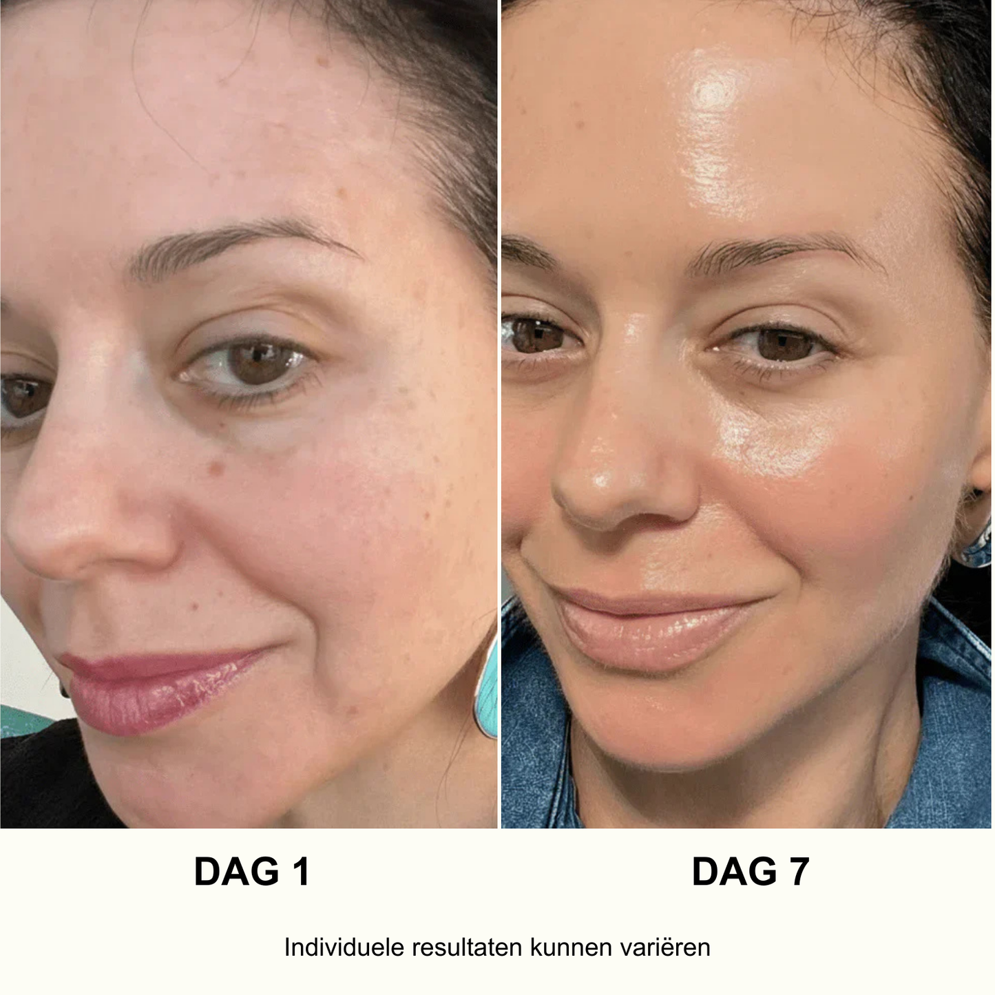 ANUA Ultieme Koreaanse Huidverzorgingsset